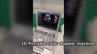 US15 Plus 2D Macchina color doppler portatile