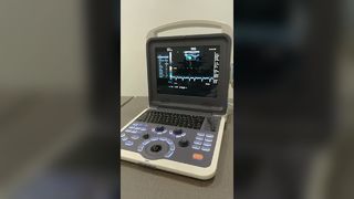 BR-US22 Macchina ad ultrasuoni