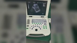 Sistema diagnostico a ultrasuoni per laptop completamente digitale 80 elementi BR-US11