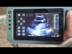 Ecografo veterinario portatile BR-VET8