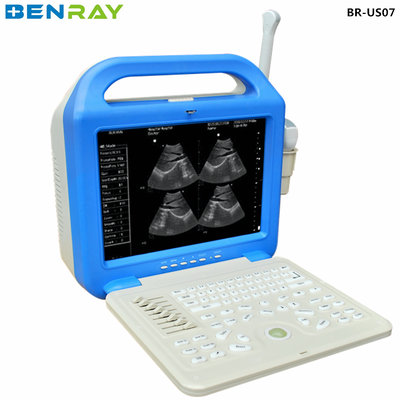 Apparecchiatura di diagnosi ultrasonica del computer portatile digitale per l'uomo