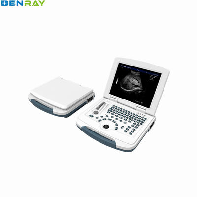 Sistema diagnostico a ultrasuoni per laptop completamente digitale 96 elementi