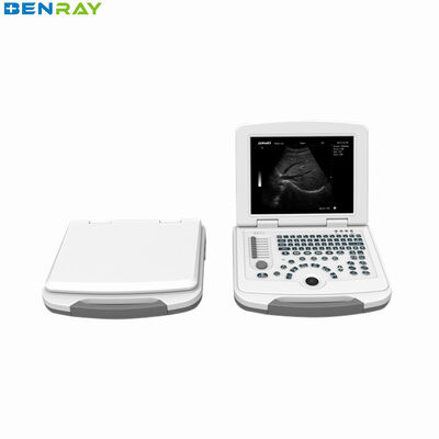 Sistema diagnostico a ultrasuoni per laptop completamente digitale 80 elementi